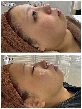 スリーズララ(Cerise LaLa)/