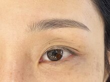 エルブリンク(elblink)