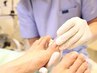 【巻き爪補正4ヵ所】