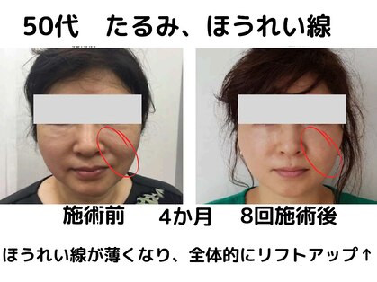 エンジェルエッグの写真