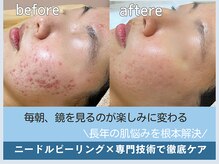 アロマ(AROMA)