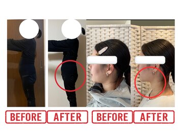 ヨサパーク ミュウ ヨシムラテン(YOSA PARK MIU)