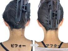 ちゅら肌 沖縄の雰囲気（完全都度払い［痩身/ヘッドスパ/脱毛］うなじ美人脱毛◎）