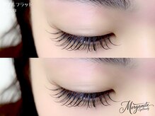 モルガナイトアイビューティー(Morganite EyeBeauty)/