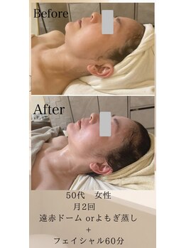 リブ 三軒茶屋(LiB)/たるみ、ほうれい線ケアも