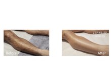 ニコ(nico)/剛毛もお任せください