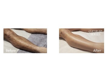 ニコ(nico)/剛毛もお任せください