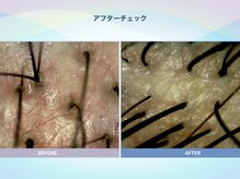 アンス(anth:)/お客様の仕上がり