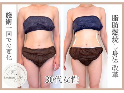 ヨサパーク ピクシス(YOSA PARK)の写真
