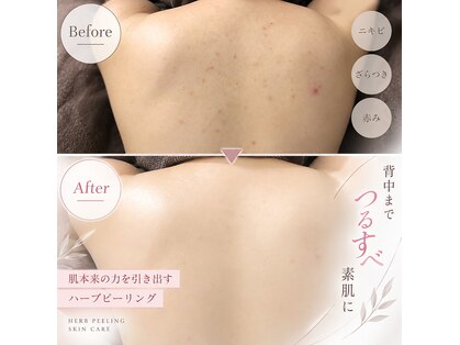 リアン(lien)の写真