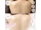 リアン(lien)の写真