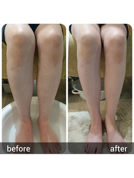 ミューク 自由が丘(mjuk)/むくみ改善◎関節エステ+リンパ