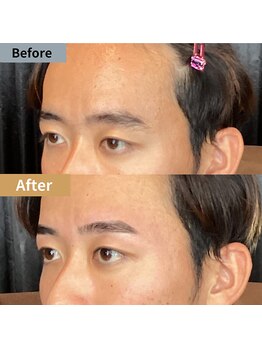 眉毛ハウス 吉祥寺店(眉毛HOUSE)/お客様の施術例(吉祥寺/東京)