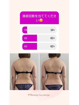 ティティビューティ ラ・クエージ金山(TTBeauty)/施術何回目?