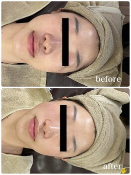 ジャスミン(Jasmin)/ホワイトニングフェイシャル