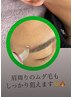 【LEDメンズ脱毛】　細部まで可！ピンポイント脱毛　¥1000