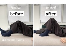 由利本荘整体院/施術ビフォーアフター（膝）