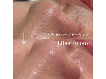 リベルキョウト 京都駅前店(Liber Kyoto)/毛穴レス艶肌コース