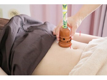 アカリコ鍼灸(Akariko鍼灸)/オーダーメイド：棒のお灸