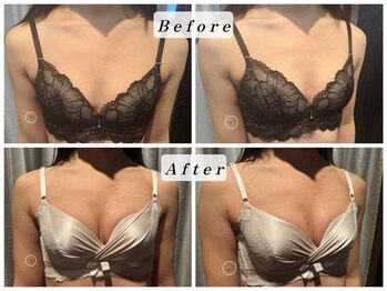 エステティックサロン パヒューム(Esthetic Salon Perfume)/上半身に脂肪がつかない…