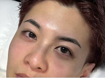 イル(il)の写真/完全個室★清潔感と垢抜けを叶えるメンズ脱毛。毎日のヒゲ剃り負担を減らし、印象UPと自信を引き出します！