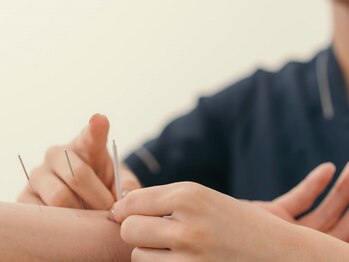 みくる整骨院の写真/【美容鍼が初めての方も◎】小顔矯正×美顔鍼セットで変化を実感。鏡を見るのが楽しく自信の持てる小顔へ♪