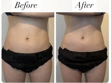 ハーバシー ラボ(herbacie LABO)/最新痩身マシンでくびれをget!