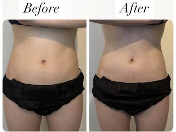 ハーバシー ラボ(herbacie LABO)/最新痩身マシンでくびれをget!