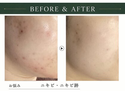 アディッシモ(addissimo)の写真