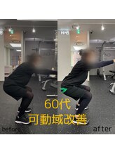 ビヨンド 札幌大通店(BEYOND)/女性 60代 ビフォーアフター