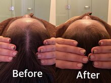 整顔整頭/小顔ケア