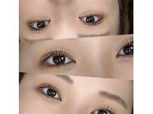 ラナン(Lanan)/進化系高濃度トリートメント