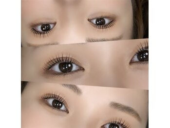 ラナン(Lanan)/進化系高濃度トリートメント