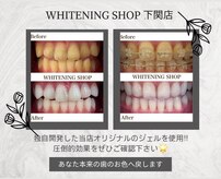 ホワイトニングショップ 下関店