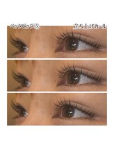 メルシートータルビューティー(MERCI)/