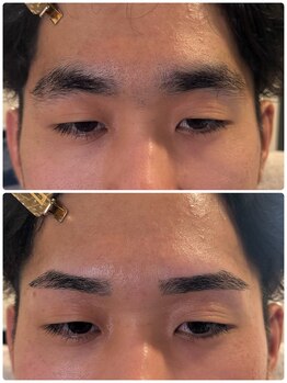 スリーピース(3Peace)/Before/After