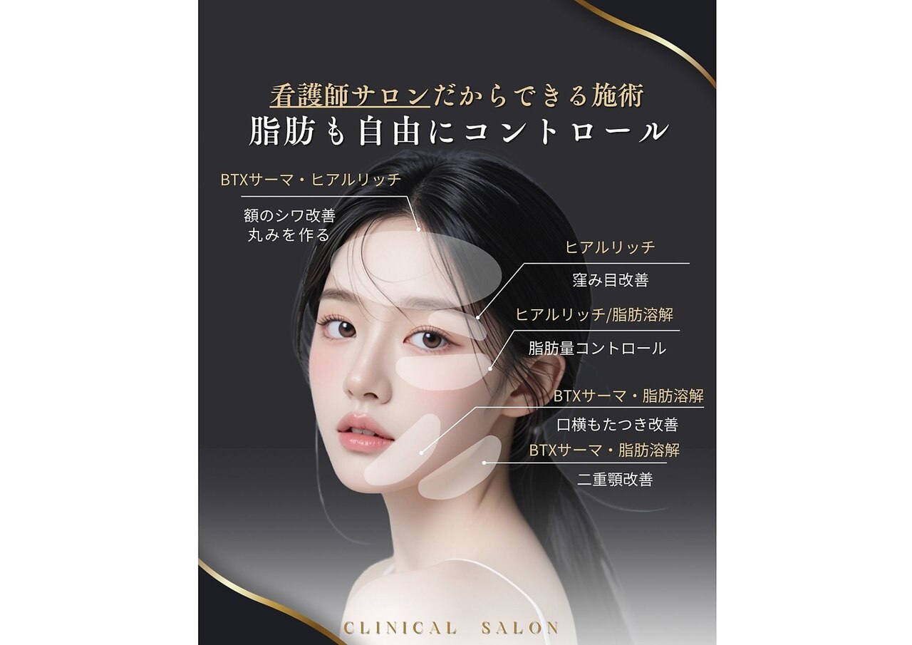 リッシュ 神戸岡本院(RICHE)|ホットペッパービューティー リッシュ 神戸岡本院(RICHE)|ホットペッパービューティー