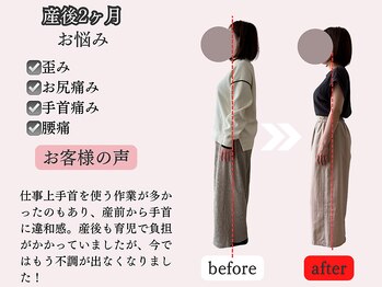 アオラド(Aolado)/手首痛み・お尻痛み