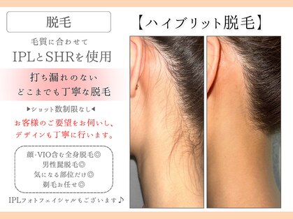フレイヤ(FREYA)の写真