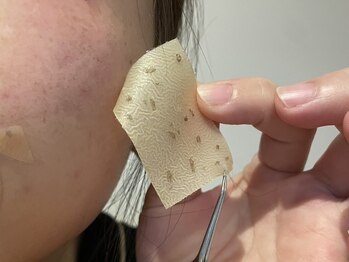 エターナルビューティー(eternal beauty)の写真/【いつまでも若々しい印象】肌を活性化させお肌のトラブルを解消◎プラチナフォト&ハイドロケア★