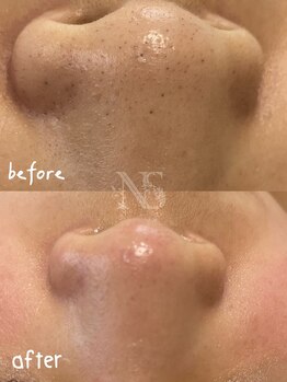 ナチュラ ソース(NatureSouce)/