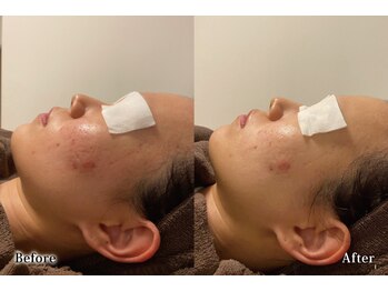 アネル 宮古島店(anel)/