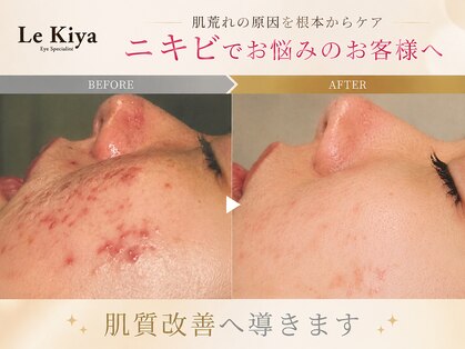 ル キヤ アイスペシャリテ ハービスENT店の写真