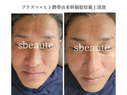 エスボーテ(sbeaute)の写真