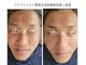エスボーテ(sbeaute)の写真