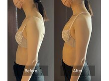 ハートランド(HEARTLAND)/プチ・クレオパトラ　1回