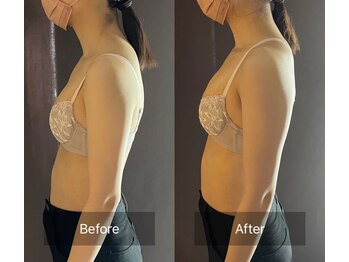 ハートランド(HEARTLAND)/プチ・クレオパトラ 1回