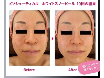 オレンジバナナ 県央店/【ホワイトスノーピール】