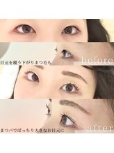 ハセミキ(Hase Miki)/アップフォースリフト（まつパ）