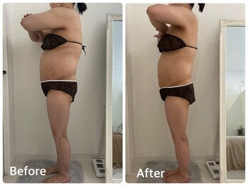 ナビ(NABI)/ぽっこりお腹撃退3回